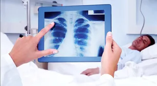 Tuberculosis: cómo se contagia y cuáles son los síntomas