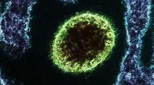 Alerta en India: un chico de 14 años murió por el virus Nipah y los científicos advirtieron del "potencial pandémico"