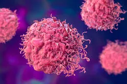 Cada vez hay más casos de cáncer en menores de 50 años