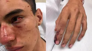 Un rugbier sufrió una brutal paliza y sugirió que hubo ensañamiento por el crimen de Fernando
