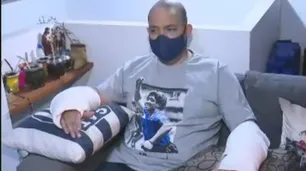 Salvaje ataque de un pitbull a un hombre: "Tengo mordeduras que llegan hasta el hueso"