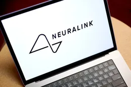 Elon Musk aviva la disputa con la SEC: publicó una carta que revela la investigación de Neuralink