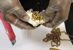 Aduana detiene a un hombre con un kilo de oro en el recto