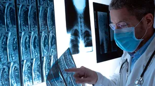 Un estudio correlaciona el virus de la mononucleosis como posible causante de esclerosis múltiple
