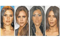 Crecen cirugías de cachetes, lo nuevo para afinar el rostro
