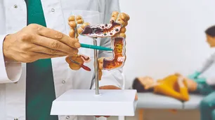 El cáncer de colon tiene 90% de probabilidad de cura si se detecta a tiempo