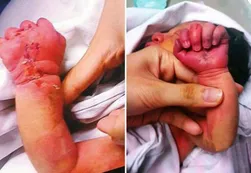 Mamá caníbal: La encontraron intentando comerse a su bebé