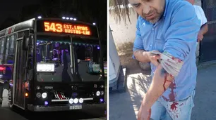 Esteban Echeverría: atacaron a balazos a un chofer y varias líneas de colectivos anunciaron paro