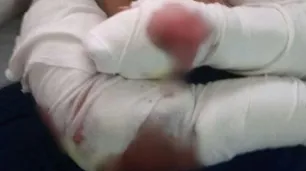 Padre de la joven atacada por una jauría: "Literalmente se la estaban comiendo"