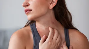 Alerta por dermatitis atópica en Argentina: advirtieron sobre demoras de hasta cinco años en el diagnóstico certero