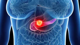 Cáncer de páncreas: una píldora duplica la supervivencia de pacientes graves