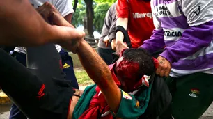 Video: un fotógrafo resultó gravemente herido durante la represión en el Congreso y pelea por su vida