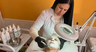 Temporada de Peeling: el tratamiento que renueva la piel y gana cada vez más popularidad