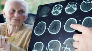 Una investigación de Cambridge descubrió que el ayuno intermitente podría prevenir el Alzheimer