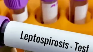 Córdoba: un hombre murió por leptospirosis en Bell Ville