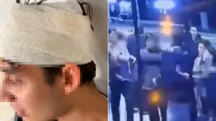 Un joven denunció golpiza de rugbiers cordobeses en Mendoza
