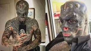 El hombre que busca ser un alien: se mutiló labios, orejas, nariz y ahora se amputará una pierna