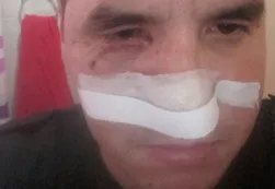 Habló el policía baleado por Castillo: "Se cubrió con la mujer y los hijos"