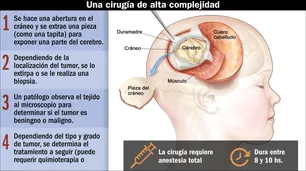 Cómo será la operación de alto riesgo a la que se someterá Máximo Menem