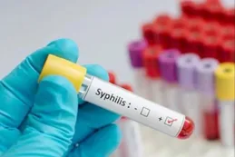 Aumentan los casos de reinfección de sífilis en la Argentina y hay alerta