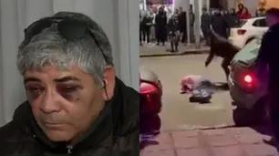 "Fueron a matarme": el relato de un hombre brutalmente agredido por tres patovicas de un boliche en Necochea