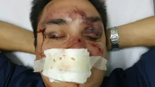 Detuvieron a un barrabrava de Racing que le dio una brutal golpiza a un periodista partidario