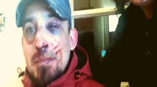 Abuso policial en Bahía Blanca: sacó a pasear a su perro y fue brutalmente golpeado