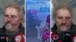 Brutal golpiza en Devoto: agredieron a un mecánico porque demoraba en entregar un vehículo