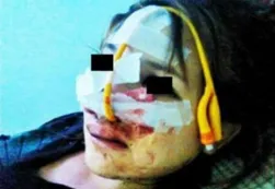 Desfiguró a su novia por haber abierto una cuenta en Facebook