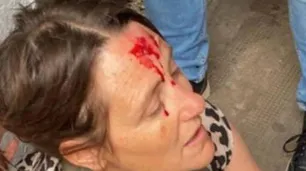 Violencia en las escuelas: una preceptora terminó herida cuando intentó separar una pelea entre estudiantes