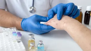 Sarampión: no se detectaron nuevos contagios y hubo provisión de vacunas