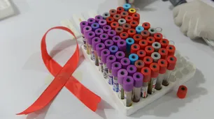 Vacuna contra el VIH: ya se realizan las pruebas de fase 3