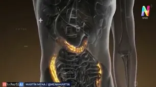 Cáncer de Colon: cómo detectarlo para tratarlo a tiempo