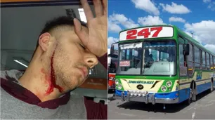 Atacaron a un colectivero para robarle: le cortaron el cuello y le quebraron un dedo