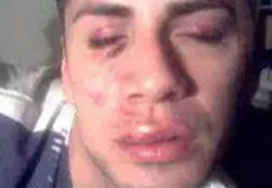 Le deformaron la cara a un joven por ser gay