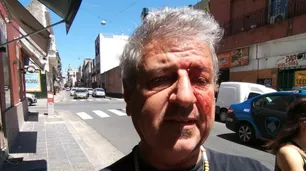 Golpearon a un periodista tras denunciar por narcotráfico a una barbería