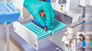 Bioquímicos alertan que podrían dejar de prestar servicios por triplicación de costos