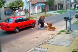 Mujer fue atacada por tres perros pitbull: recibió 11 puntos y sufre ataques de pánico