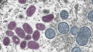 Epidemia de Mpox: aumentaron los casos y muertes en África y la OMS pidió mayor vigilancia mundial