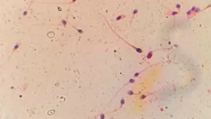 HyperSperm, la innovación argentina que mejora la fertilización in vitro y abre una nueva esperanza para miles de parejas
