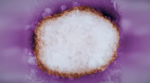 La viruela del mono ya llegó a América, mientras Europa pide vacunar contactos de riesgo
