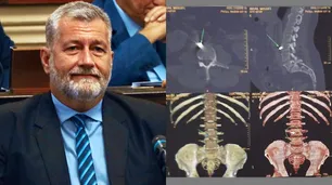 Miguel Arias, el diputado baleado en Corrientes, dijo que "sería muy bueno" el apoyo de Nación para que el atentado no quede impune
