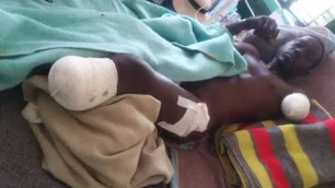 Lo corría una manada de elefantes, se tiró a un río y un cocodrilo le comió un brazo y una pierna