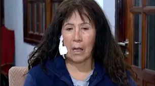 “Pensé que me estaba muriendo”: el dramático relato de la turista atacada con un ladrillazo camino a Ezeiza