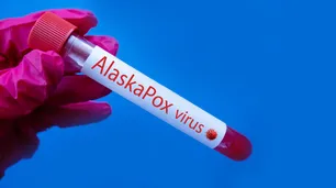 Estados Unidos: un hombre murió a causa del Alaskapox, el virus que aterroriza a Alaska
