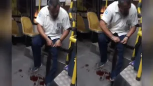 Violento ataque a un colectivero en Escobar: delincuente se negó a pagar el boleto y le disparó en la pierna