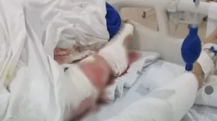Mar del Plata: una mujer caminaba por la playa y la atacó una jauría