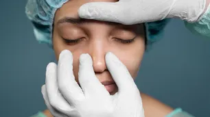 Implantan en la cara de una mujer una nariz impresa en 3D que se hizo crecer en su antebrazo