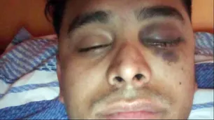 Se demoró 15 días en el pago del alquiler, el dueño le pegó con un arma y perdió un ojo