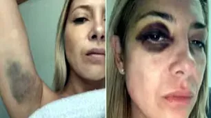 Liliana Franco sobre las presuntas golpizas de Alberto Fernández a Fabiola: “Estoy impresionada pero no me sorprende"